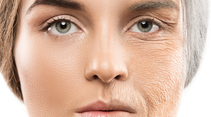 tratamento anti aging